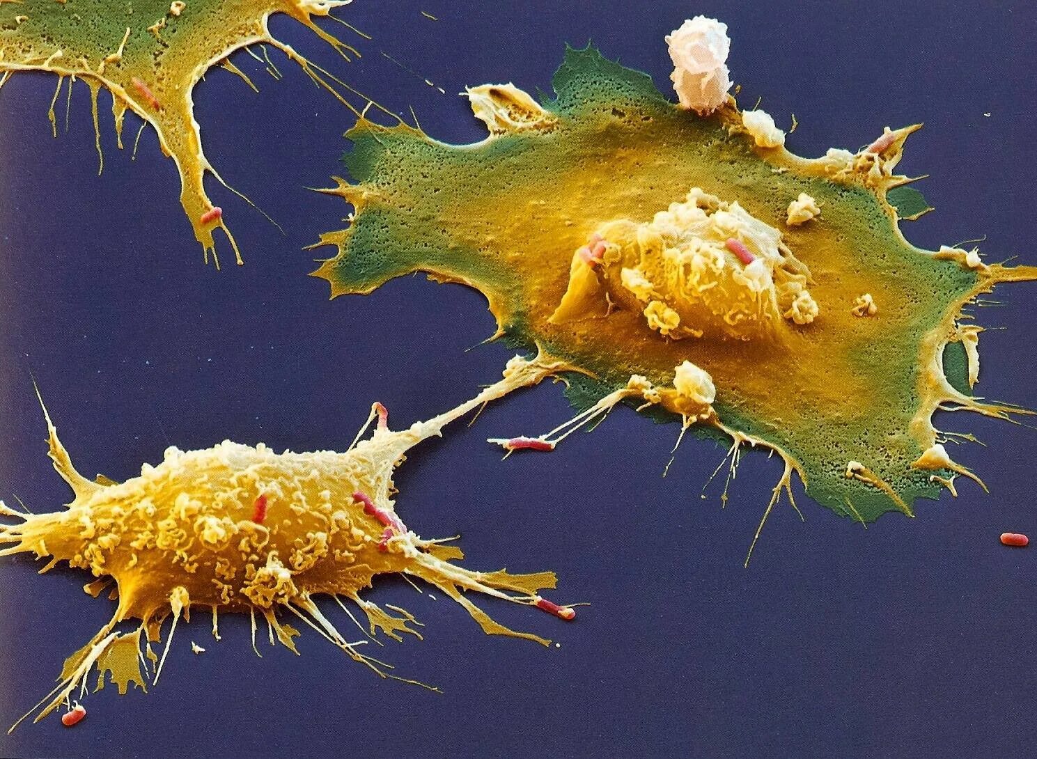 Дендритные клетки фагоциты. Микрофаги,макрофаги,киллеры. Макрофаги под микроскопом. Дендритные клетки в микроскопе. Макрофаги иммунитет