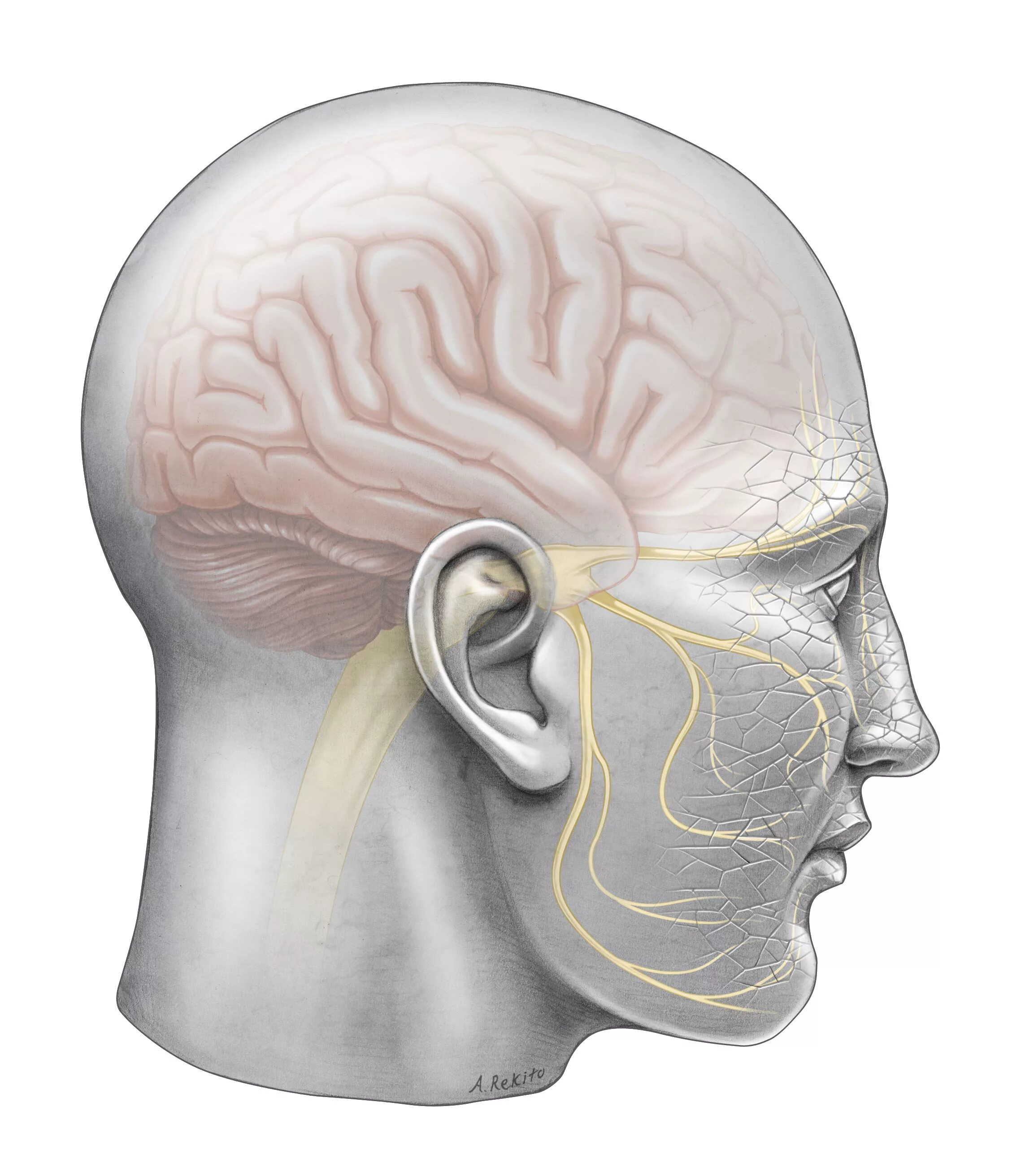 Neuralgia латынь. Trigeminal neuralgia. гассеров узел на черепе. гассеров узел тройничного нерва. тригеминальная невралгия тройничного нерва.