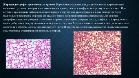 Паренхиматозные дистрофии патанатомия