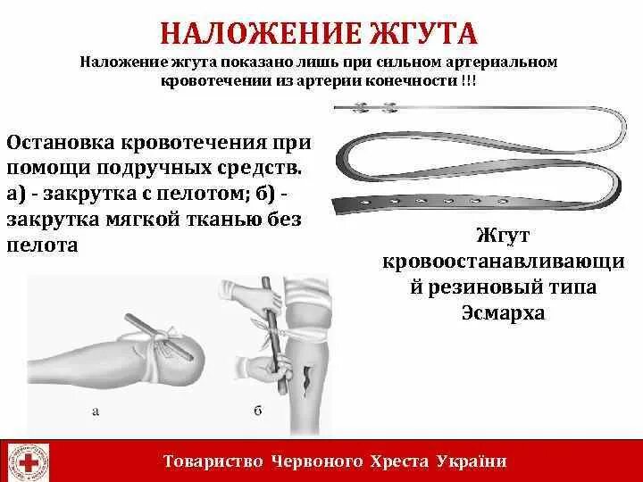 Закрутка при кровотечении. Закрутка при кровотечении