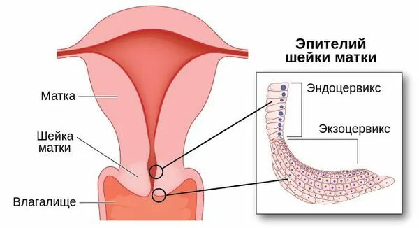 Полип цервикального канала матки. Полипы в цервикальном канале у женщин. Эндоцервикальный полип. Где находится цервикальный канал у женщин рисунок. Цервикальный канал размеры