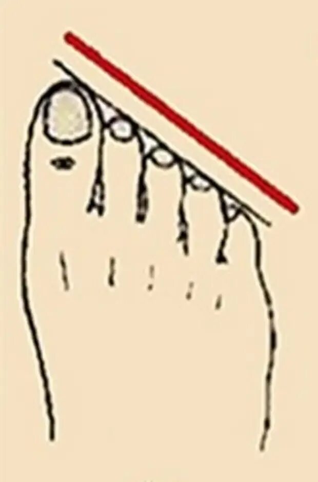 Форма стопы. Как узнать пальцы ноги. Как узнать пальцы ноги. Форма пальцев на ногах. Как узнать пальцы ноги.