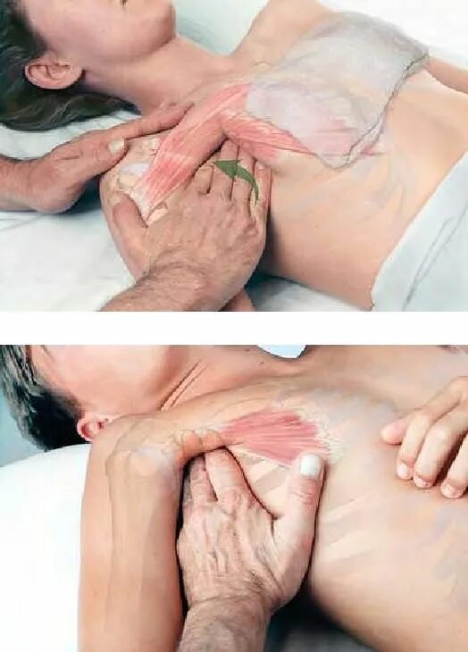 Мануальная терапия остеохондроз. Миофасциальный массаж триггерных точек. Массаж релаксирующий для мужчин. Спортивно силовой массаж. Миофасциальная мануальная терапия.