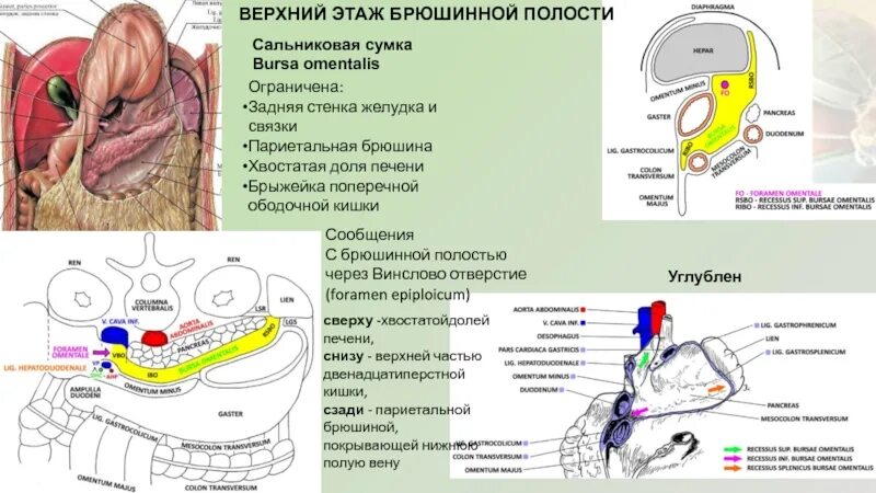 Винслово отверстие. Сальниковая сумка топографи. Сальниковая сумка – Bursa Omentalis. Сальниковая сумка желудка анатомия. Сальниковая сумка анатомия стенки.