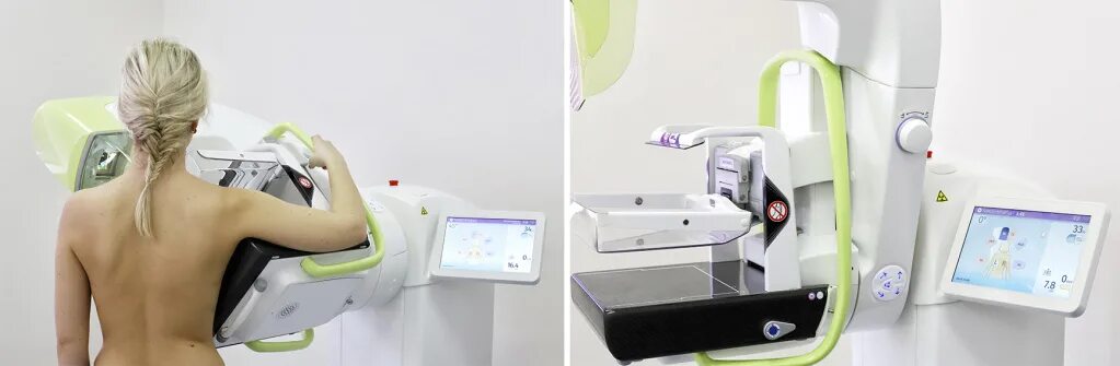 Маммография обязательно. Рентген молочных желез маммография аппарат. Малоинформативная маммография. Маммография с томосинтезом. Цифровой томосинтез молочной железы.