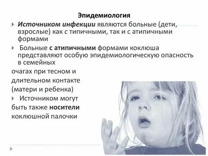 Вебинар бевза с л коклюш у детей