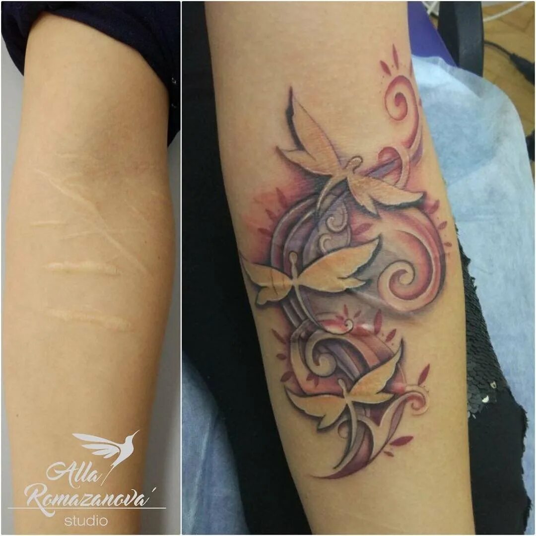 перекрытие шрамов татуировкой. тату для перекрытия шрамов на руке девушке. тату на шрамах на руке для девушек. тату на шрамах на руке для девушек. тату для перекрытия шрамов на руке девушке.