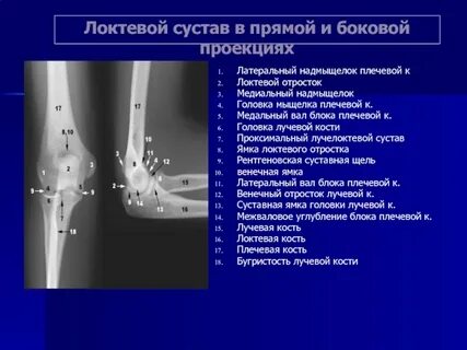 Надмыщелков плечевой кости