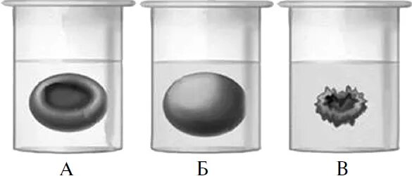 Эритроциты в растворах разной концентрации. Эритроциты в разной концентрации соли. Разная концентрация солей эритроциты. Эритроциты в растворе поваренной соли. Эритроциты в растворе хлорида натрия