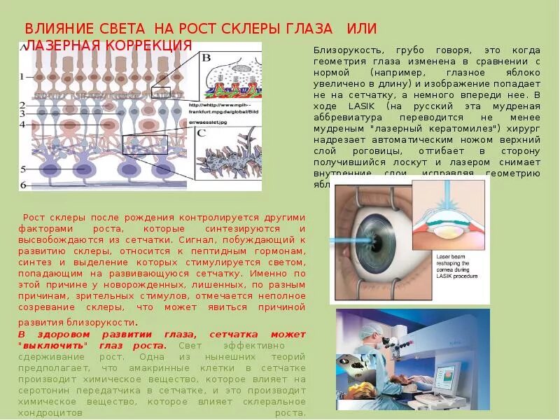 Влияет ли освещение. Как свет влияет на зрение. влияние света на зрение. воздействие света на глаза человека. влияние освещения на зрение.