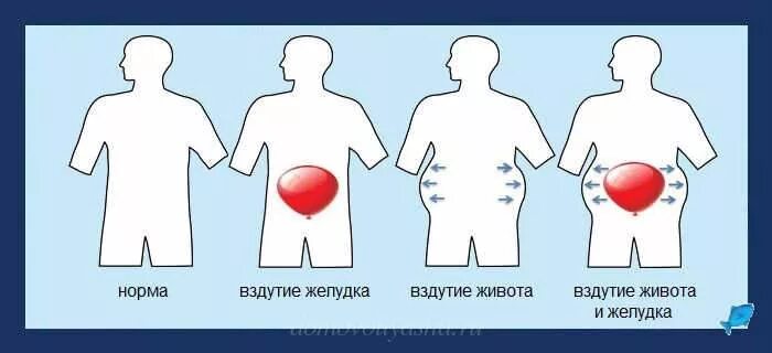 Сильно выходят газы. Вздутие кишечника и газообразование. Газообразование в животе. Вздутие живота желудка.