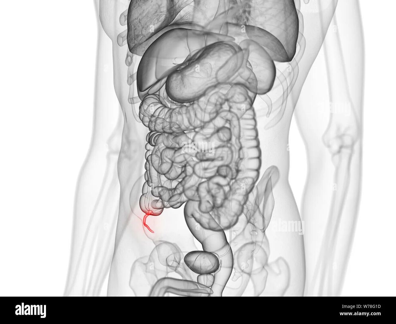 Аппендикс на теле. Органы брюшной полости аппендикс. Анатомия человека внутренние органы аппендицит.