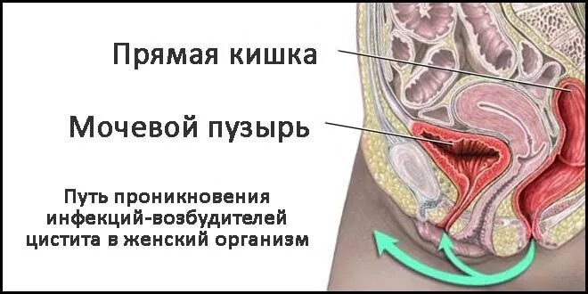 Болит низ живота мочевой пузырь у женщины. Гликозаминогликановый слой мочевого пузыря. При мочеиспускании болит низ живота. Болит низ живота мочевой пузырь у женщины. Болезненное мочеиспускание причины.