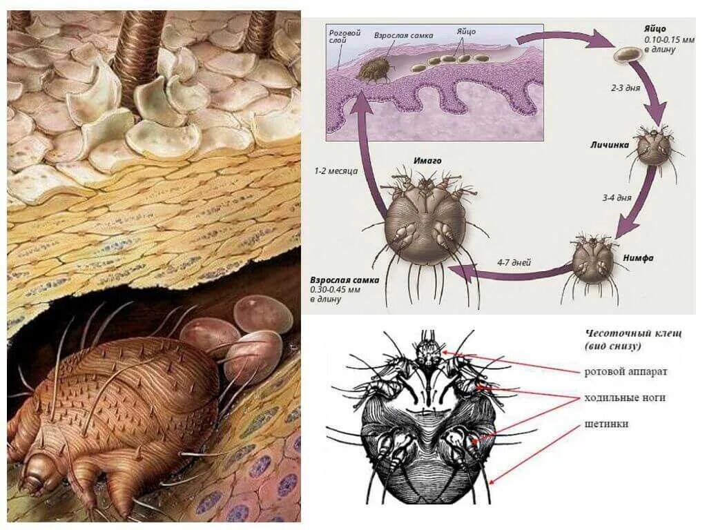 Цикл развития чесоточного клеща. Цикл развития чесоточного зудня. Чесоточный клещ жизненный цикл у человека. Стадии жизненного цикла чесоточный зудень Sarcoptes scabiei строение. Sarcoptes scabiei жизненный цикл.