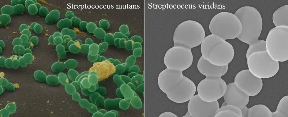 Стрептококк Streptococcus Viridans. Зеленящий стрептококк. Бактерии стрептококк мутанс. Тест стрептококк группы а