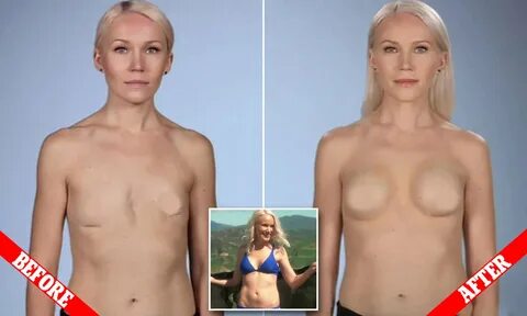 Slideshow flat chest nude women.