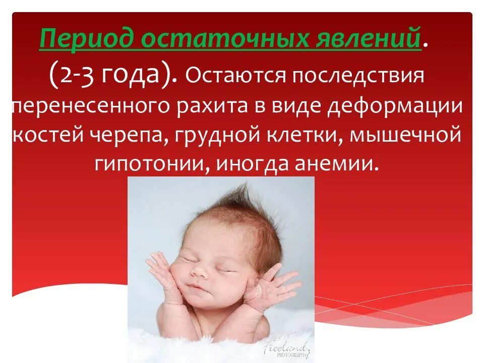 Массаж при рахите в период остаточных явлений. Остаточные явления рахита. Остаточные явления рахита. Сестринский процесс при рахите. Рахит у детей раннего возраста.