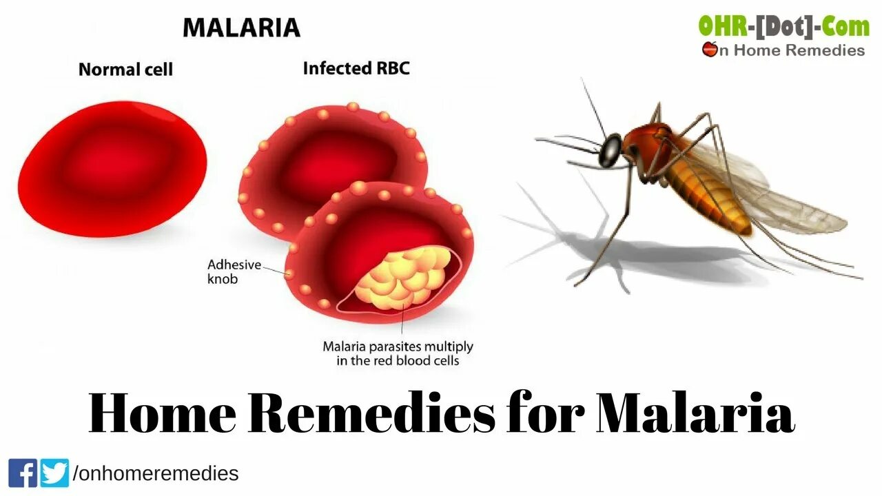 Малярия клетки. Malaria treatment. Maliaria syptoms. Тропическая малярия фото.