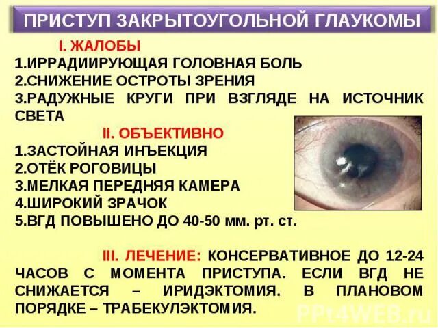 Глаукома инфографика. Глаукома болит голова. Памятка по профилактике глаукомы. Глаукома и внутриглазное давление. Заболевание глаз глаукома.