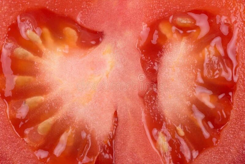 Repeat the anatomy... Fascia is a component of the soft tissues of the connectiv