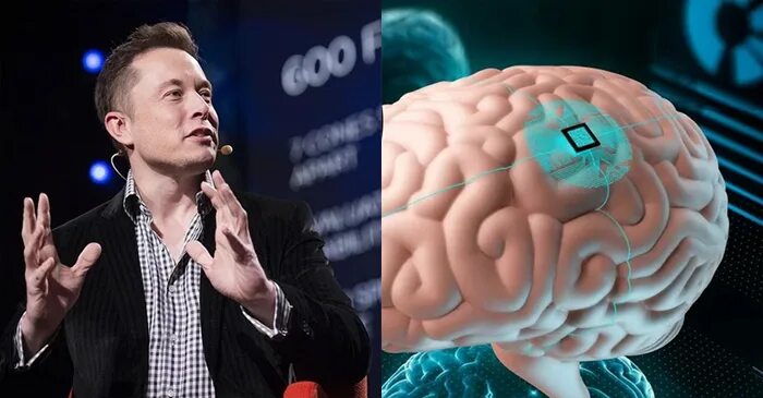 Илон маск имплант. Neuralink Илон Маск. Neuralink чип. Илон Маск чип. Илон Маск вживил чип.