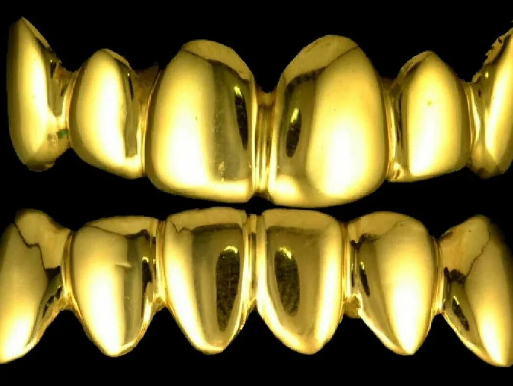 Коронка штампованная напыление Титан. Напыление зубных коронок нитридом циркония. Золотой мостовидный протез.