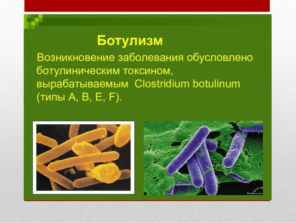 Clostridium spp. Ботулизм бактерия возбудитель. Клостридии ботулизма. Клостридия ботулизма бактерия. Ботулизм возбудитель отравление.