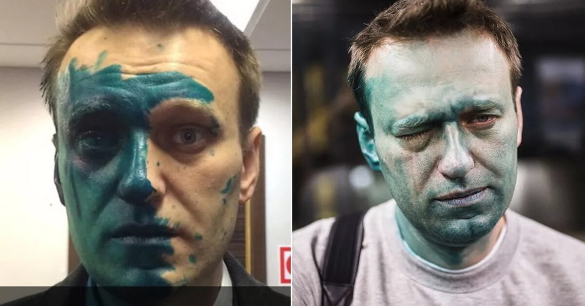Навального облили зелёнкой. Навальный мразь
