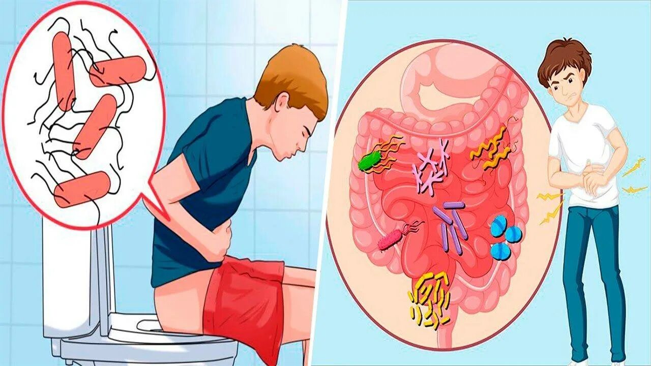 Почему блюешь водой. Отравление понос. Желудочно кишечное отравление. Кишечная инфекция человек. Диарея у детей пищевая токсикоинфекция.