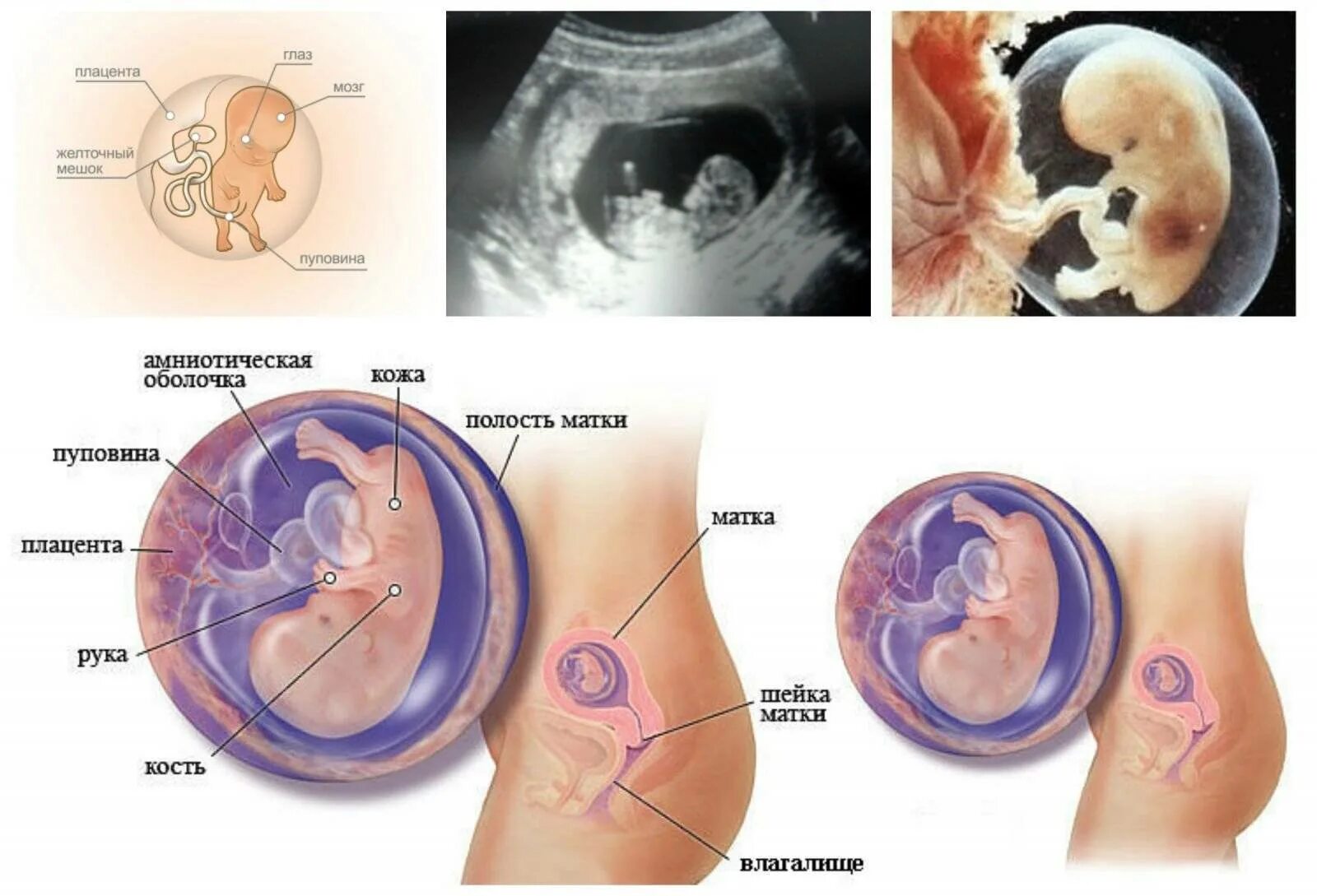 Ребёнок на 10 неделе беременности. 10 Недель беременности размер матки и плода. Размер эмбриона в 10 недель. Размер ребёнка на 10 неделе беременности.