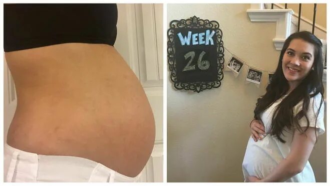 27 недель отзывы. Многоплодная беременность живот. Живот на 26 неделе. Животик на 26 неделе беременности.