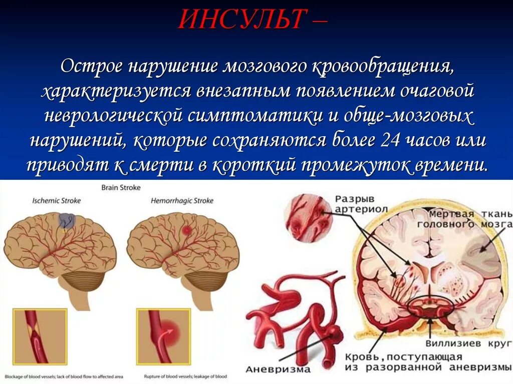 Острые нарушения кровообращения цнс. Острое нарушение мозгового кровообращения. Острым нарушение кровообращение мозга. Нарушение кровотока в головном мозге. Нарушения мозгового кровоснабжения.