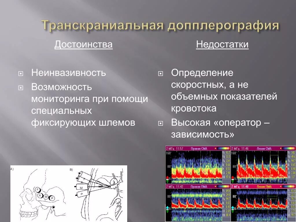 Транскраниальных артерий и вен. Транскраниальная ультразвуковая допплерография. Транскраниальной допплерографии. Транскраниальная допплерография сосудов.