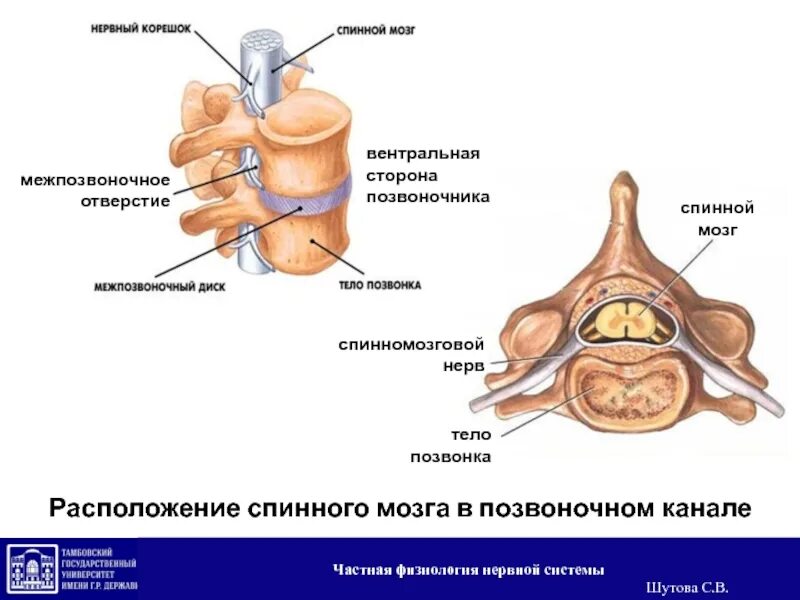 нейруляция у человека. трубчатая нервная система позвоночных. образование нервной трубки. пороки развития нервной трубки плода. Spina bifida крестцового отдела позвоночника.