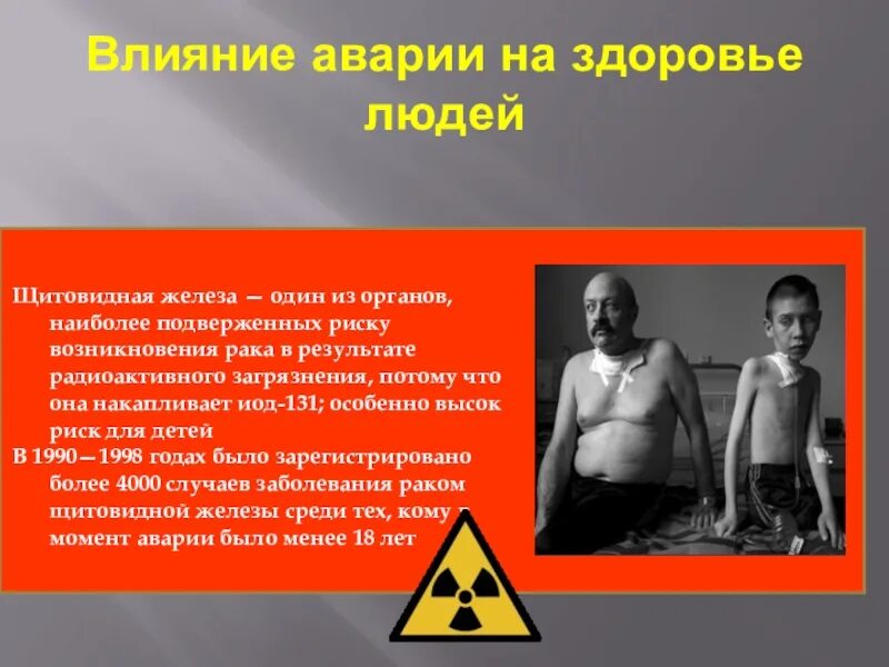 Авария на Чернобыльской АЭС влияние на людей. Последствия радиации Чернобыля АЭС. Последствия влияния радиации на человека. Влияние аварии на Чернобыльской АЭС на здоровье людей. Радиация кожи