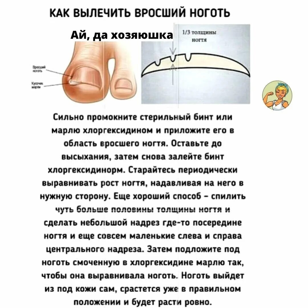 Для чего нужно знать, как врастает ноготь?