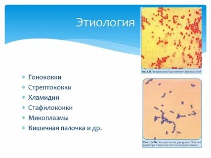 Гонококки стрептококки
