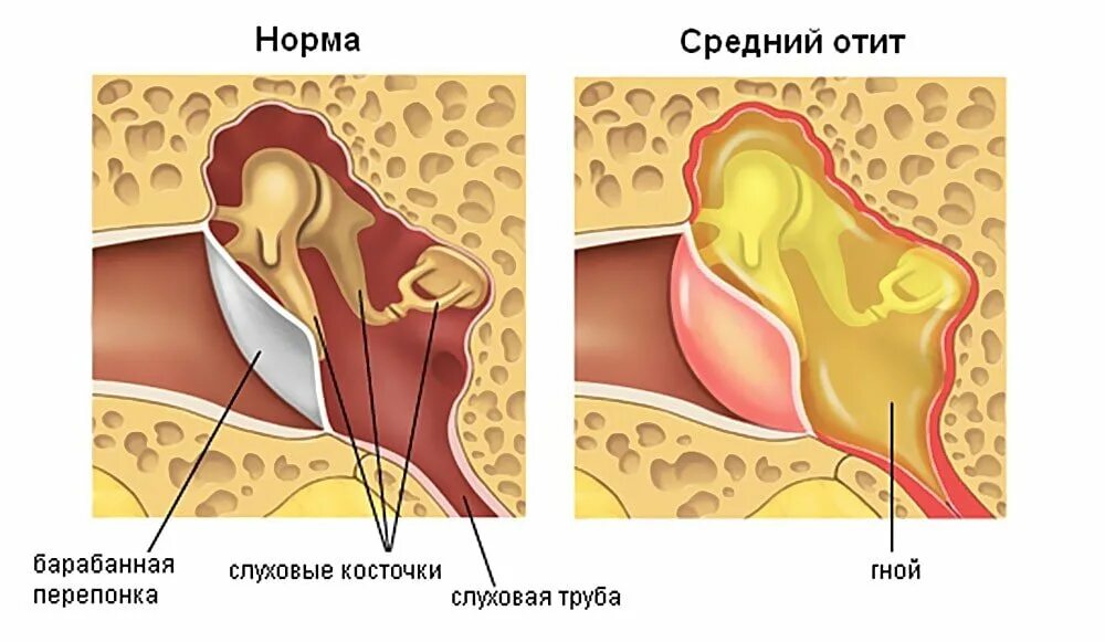 В ухе как будто стучит сердце