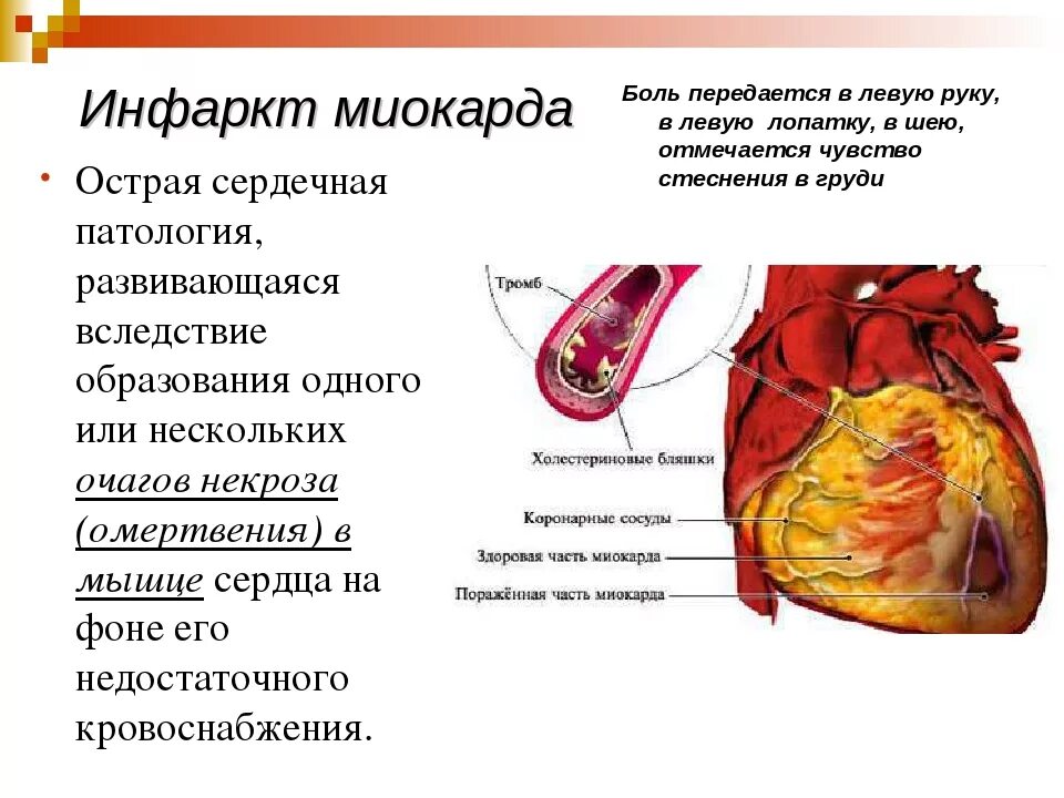 Тест по теме сердца