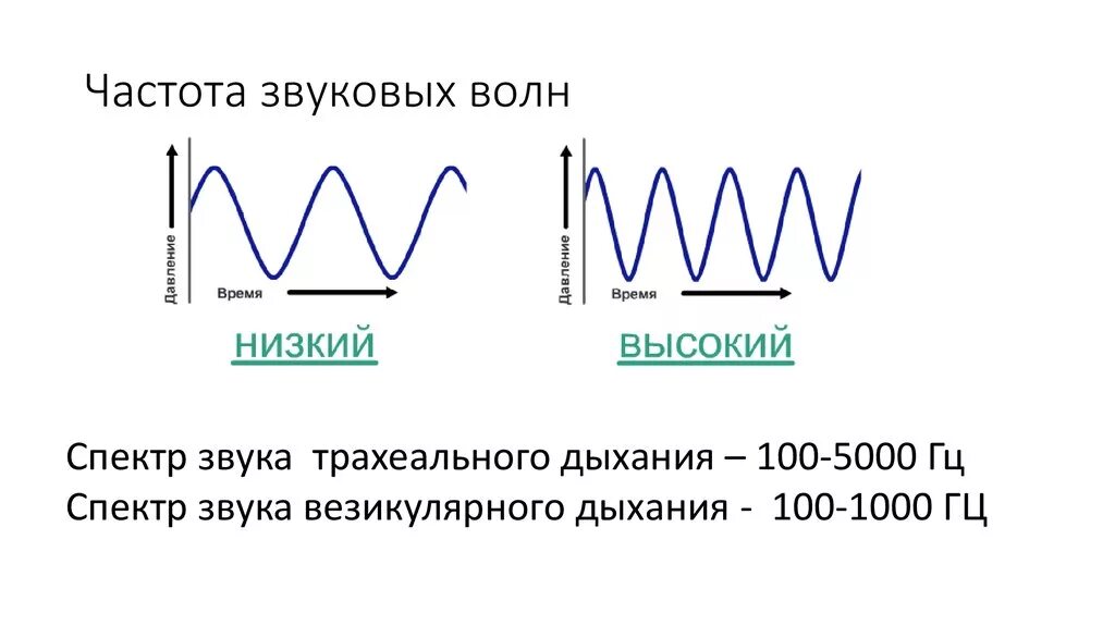 Верхние частоты звука