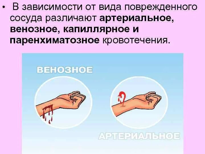 Временные способы остановки капиллярного кровотечения. Способы остановки кровотечений артериальное венозное капиллярное. Методы остановки капиллярного кровотечения. Капиллярное кровотечение способы остановки кровотечения.