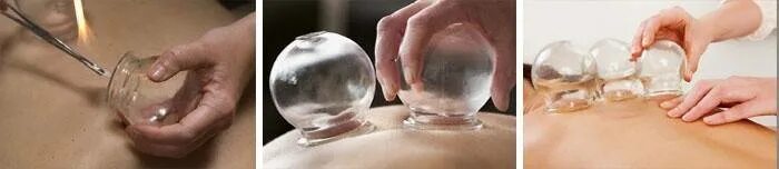 как ставить стеклянные банки