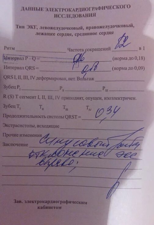 Протокол ЭКГ исследования. Направление на ЭКГ. ЭКГ заключение норма. Протокол заключения ЭКГ. Заключения экг примеры