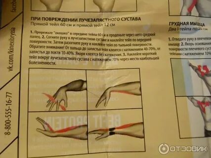 Тейпирование при туннельном синдроме