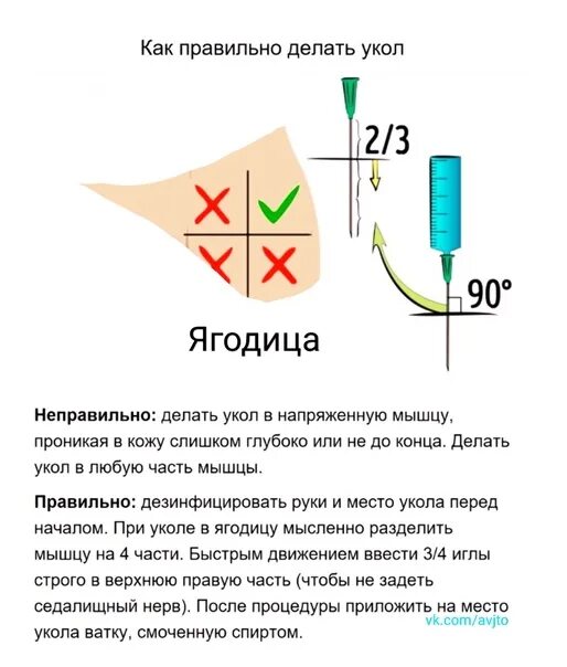 Правильно ставить уколы внутримышечно. Как правильно делать укол в ягодицу. Как сделать правильно укол в ягодицу взрослым. Как правильно делать укол внутримышечно.