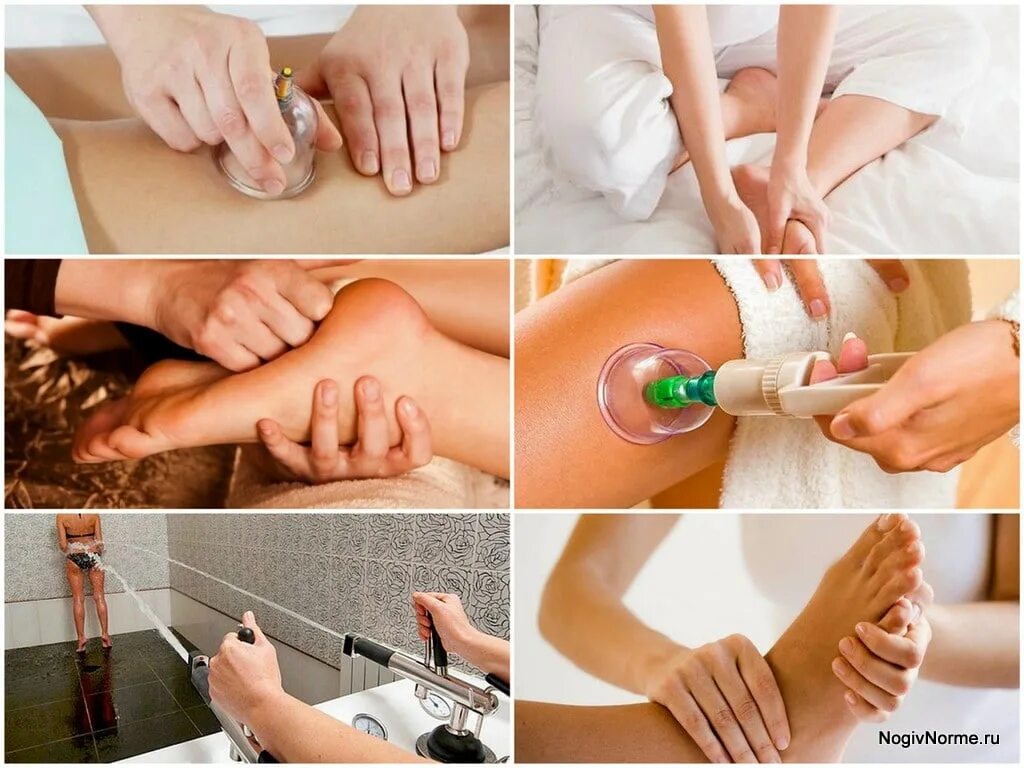 Лимфодренажный массаж ног домашних. Техники массажа ног. Массаж ступней.