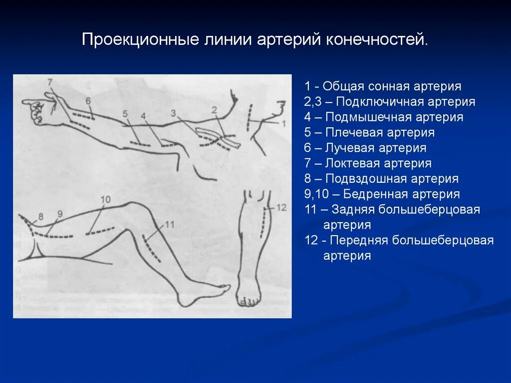 Верхней линии. Проекционные линии артерий конечностей. проекционные линии сосудов и нервов на конечностях. проекционные линии подкрыльцовой артерии.. проекционные линии магистральных сосудов конечностей.