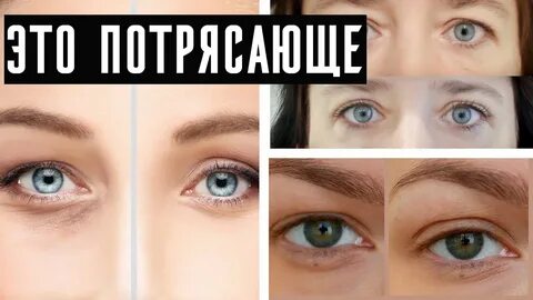 Нависшее веко маски