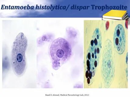 Entamoeba histolytica