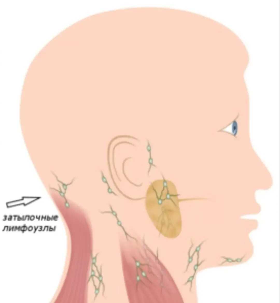 Лимфоузлы на затылке у ребенка схема. Лимфоузлы затылочные воспалились затылочные лимфоузлы. Заушные лимфоузлы воспаление. Затылочные лимфоузлы расположение затылочные.